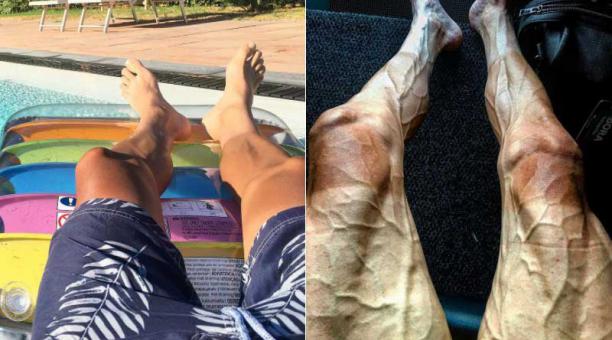 A la izquierda las piernas del competidor hace un año en vacaciones, a la derecha sus piernas en plena competencia. Fotos: Intagram