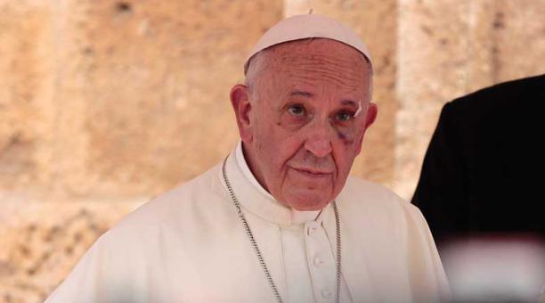 El Sumo Pontífice luce la herida que le quedó con le golpe en el Papamovil. Foto: EFE