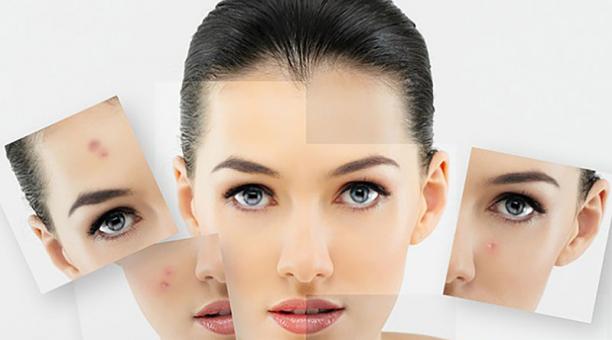 Antes de adqui­rir la línea de cuidado facial, hay que saber si la piel es normal, seca, grasa, mixta o sensible.